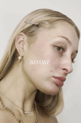 DeAurora IDUN Wrinkle-Eraser Serum 30ml